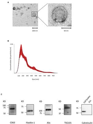 Extracellular Vesicles Derived From Murine Cementoblasts Possess the Potential to Increase Receptor Activator of Nuclear Factor-κB Ligand-Induced Osteoclastogenesis